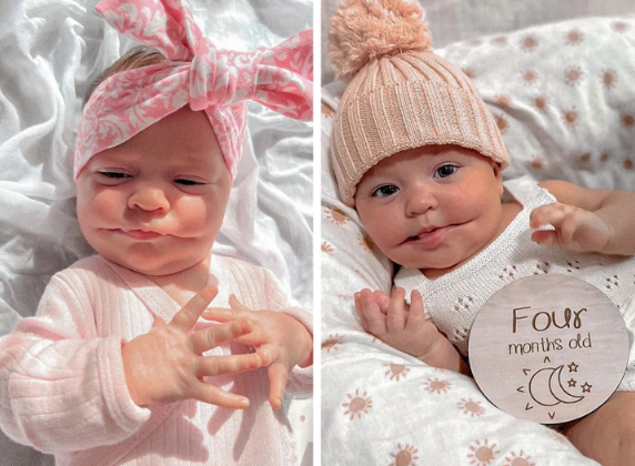 She Had The World's Rarest Condition.  But When You See Her Today